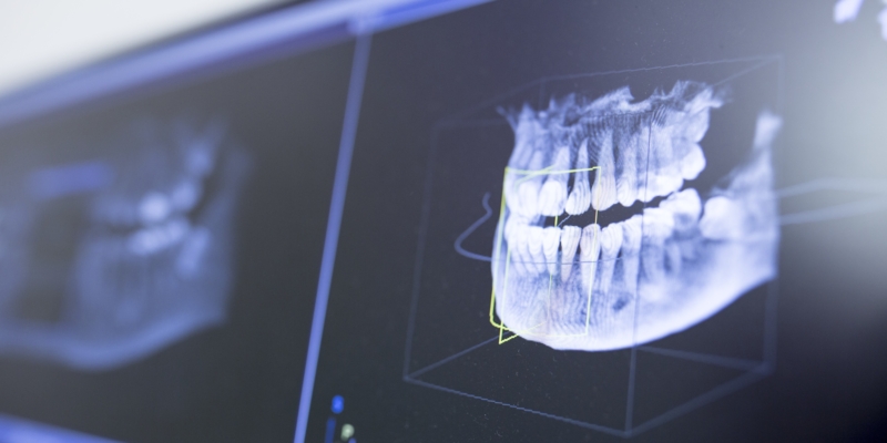Close-up of teeth x-ray in dentist clinic.