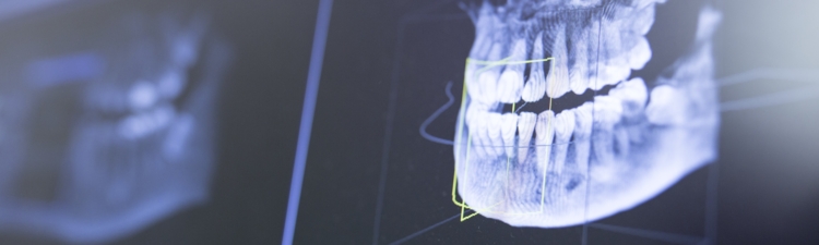 Close-up of teeth x-ray in dentist clinic.